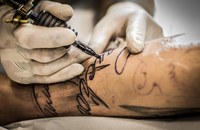 Laser-Klinik offeriert 50% Discount für die Entfernung von Harry Potter-Tattoos