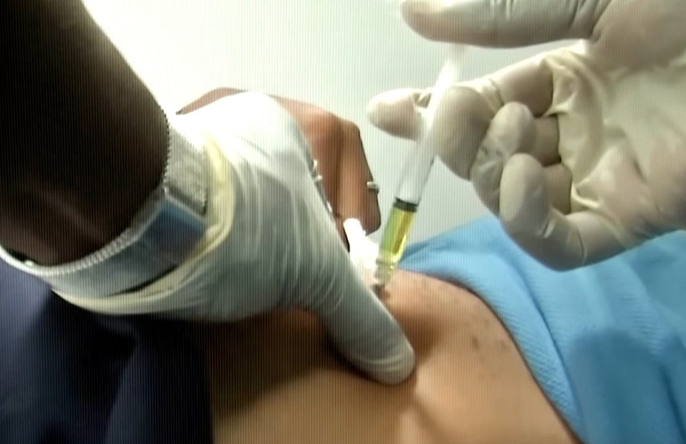 Watch: Könnte ein neues Medikament die HIV-Pandemie beenden?