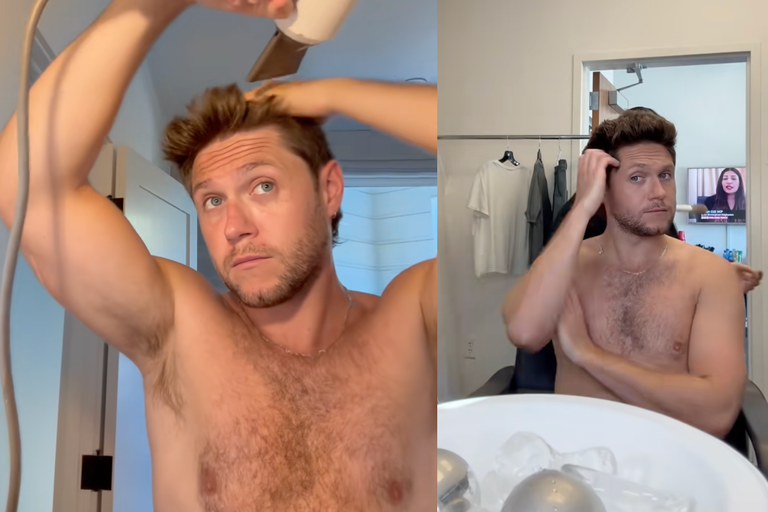 Watch: Niall Horan zieht alle Register...