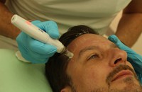 BEAUTY: Microneedling für ein frisches Gesicht