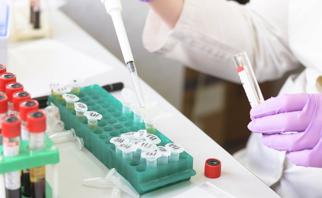 GESUNDHEIT: Neue Hoffnung um HIV über einen noch längeren Zeitraum zu unterdrücken