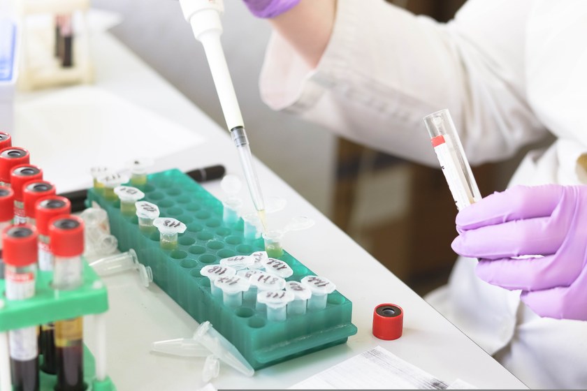 GESUNDHEIT: Neue Hoffnung um HIV über einen noch längeren Zeitraum zu unterdrücken