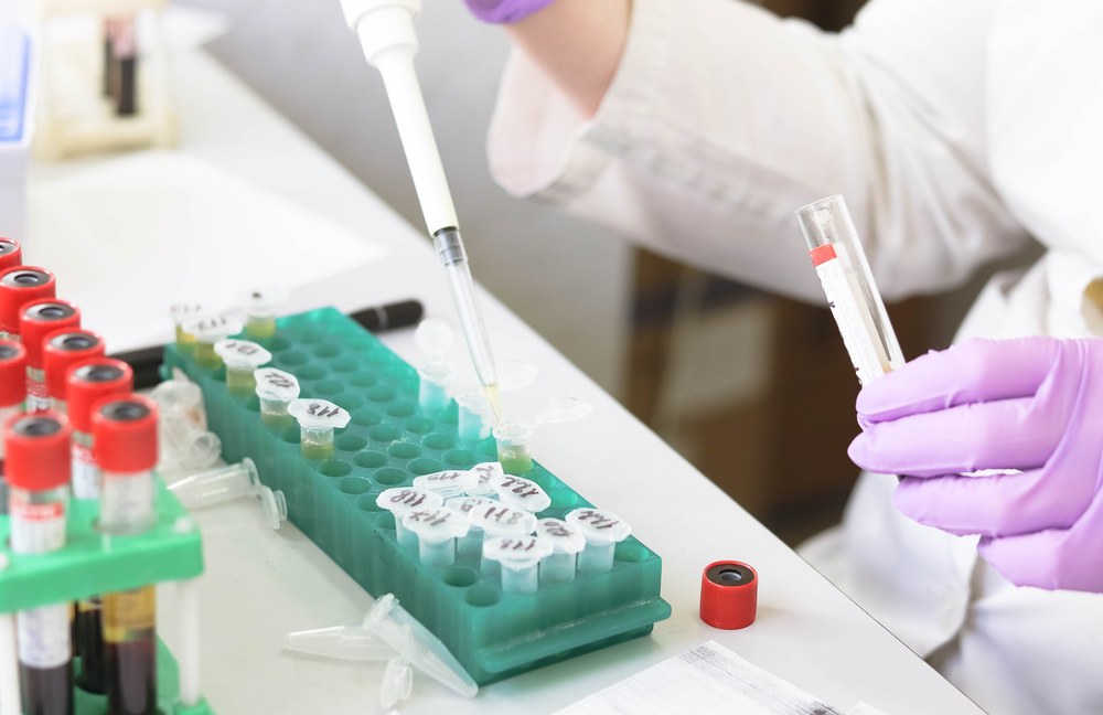 GESUNDHEIT: Neue Hoffnung um HIV über einen noch längeren Zeitraum zu unterdrücken