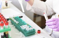 GESUNDHEIT: Neue Hoffnung um HIV über einen noch längeren Zeitraum zu unterdrücken
