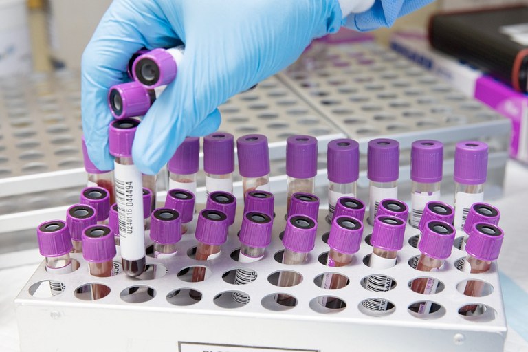 GESUNDHEIT: Schon wieder ein neuer Mpox-Stamm - diesmal in UK