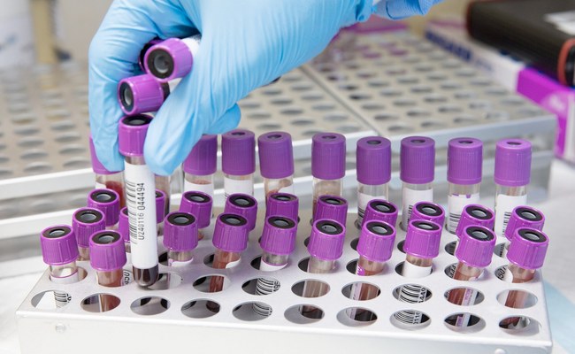 GESUNDHEIT: Schon wieder ein neuer Mpox-Stamm - diesmal in UK