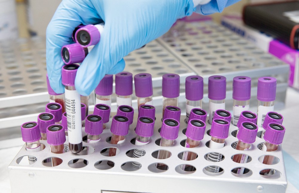 GESUNDHEIT: Schon wieder ein neuer Mpox-Stamm - diesmal in UK