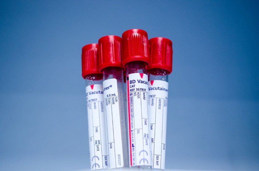DEUTSCHLAND: Blutspendeverbot für MSM soll fallen