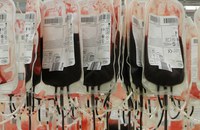 KANADA: Blutspendeverbot für MSM auf drei Monate gesenkt