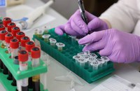 MEDIZIN: Durchbruch mit neuem HIV-Test