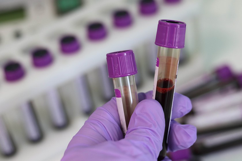 MEDIZIN: Neue Tests mit HIV-Impfungen beginnen