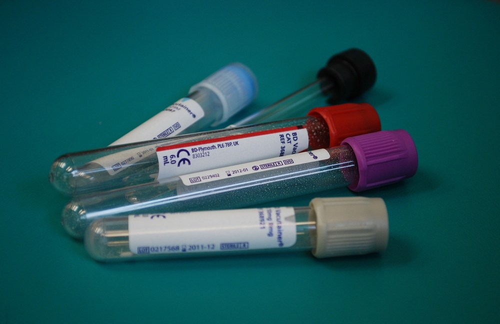 MEDIZIN: Wurde der bereits zehnte Mensch von HIV geheilt?