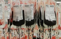 SCHWEIZ: Ab dem 1. November gelten die neuen Blutspende-Regeln