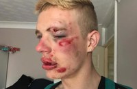 UK: Junger Mann bei möglichem Hassverbrechen spitalreif geprügelt
